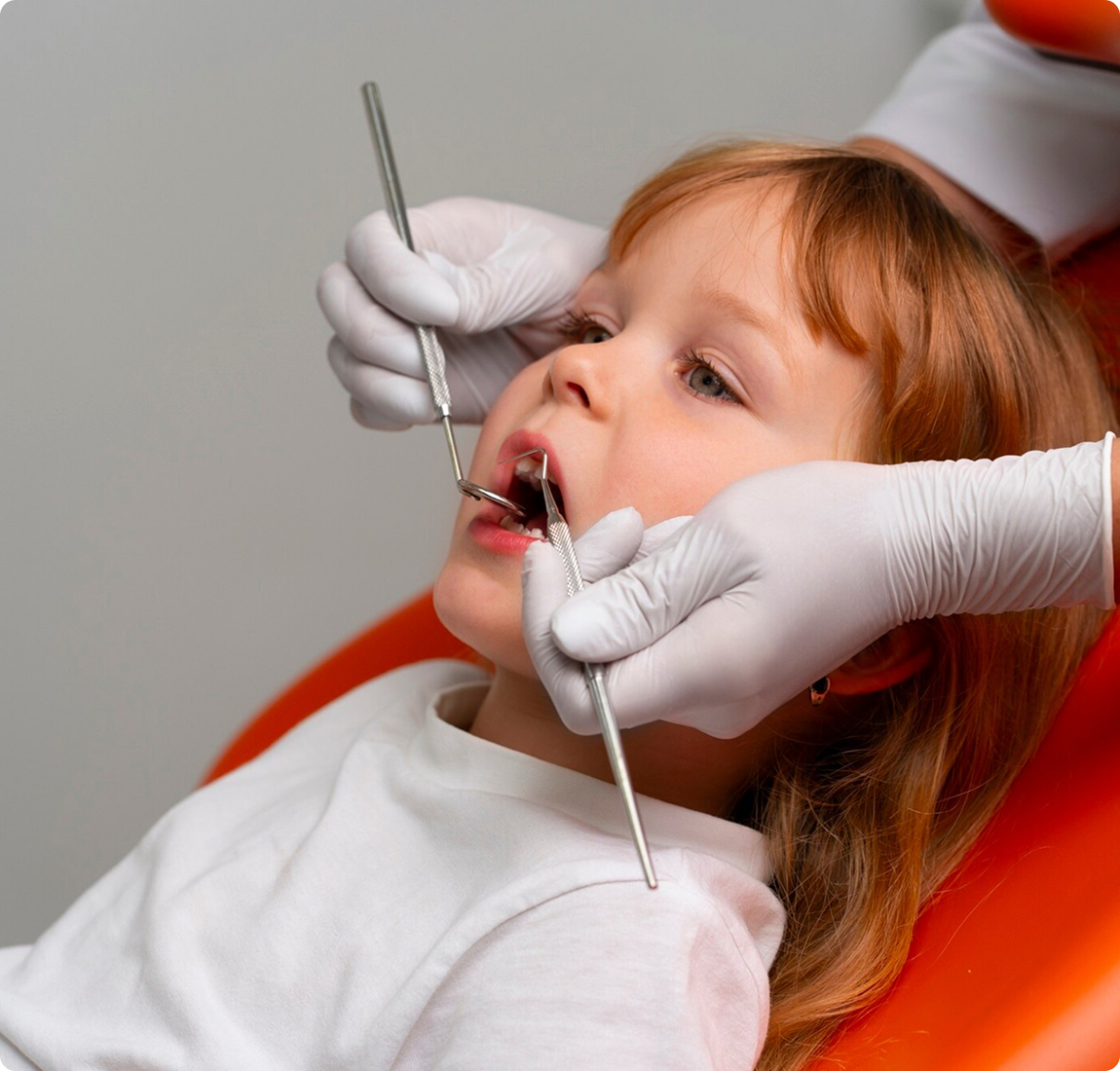 Удаление зубов у детей