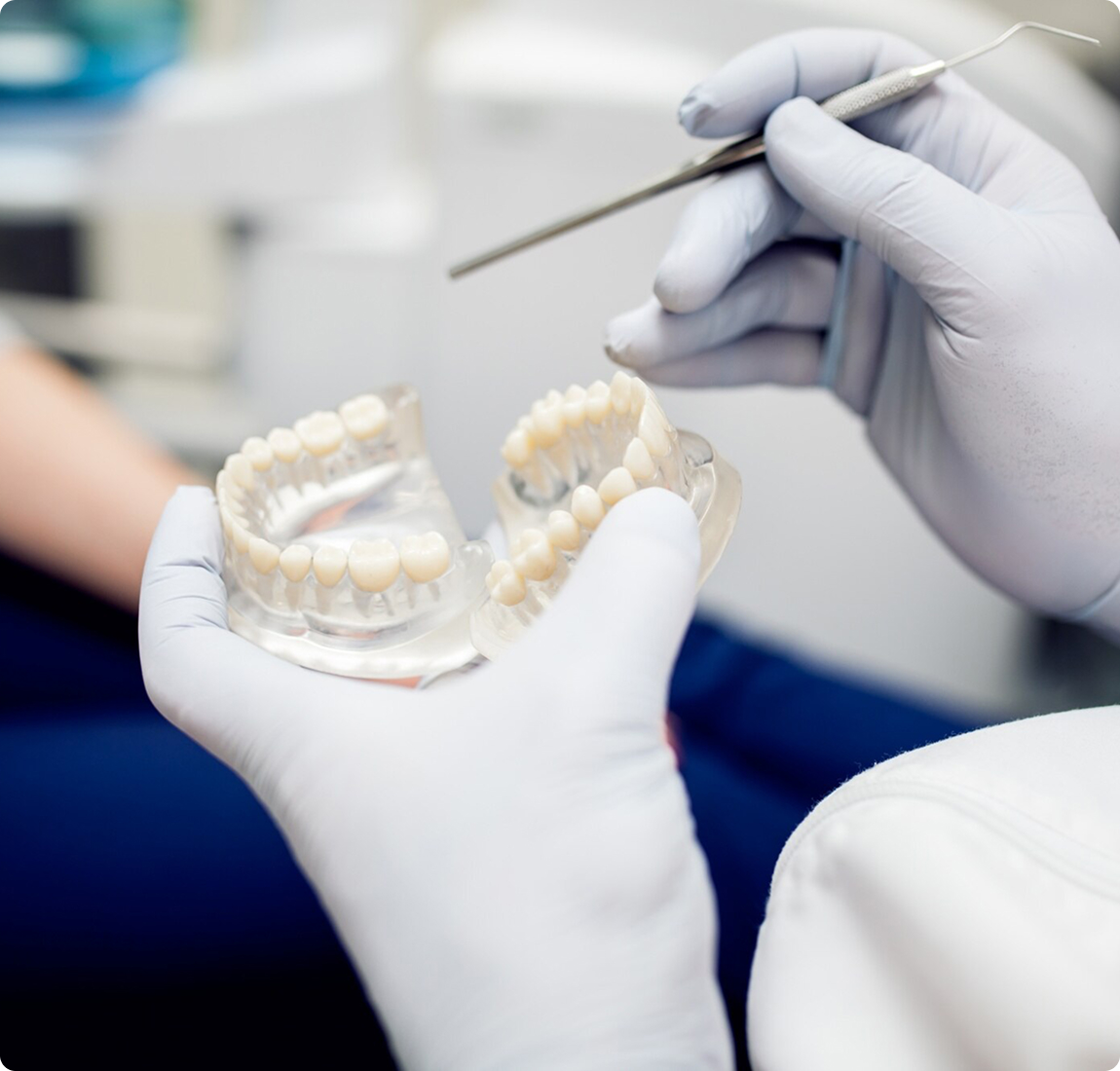 Стоимость имплантации зубов