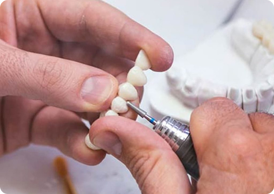 Коронка на зуб: «как», «зачем» и «почему» простыми словами